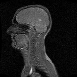 First MR scan with the MRcollar applicator