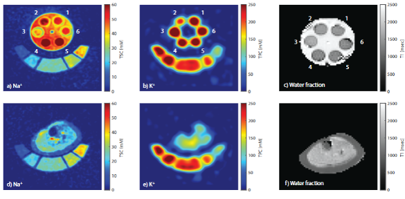 TiCEPT electrical properties tomography